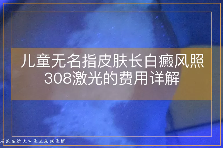 儿童无名指皮肤长白癜风照308激光的费用详解