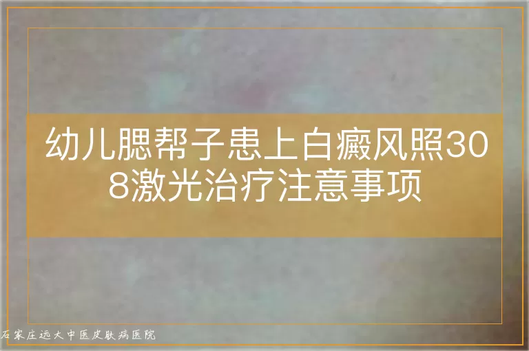 幼儿腮帮子患上白癜风照308激光治疗注意事项