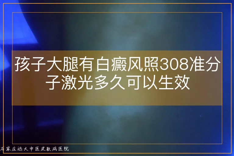孩子大腿有白癜风照308准分子激光多久可以生效