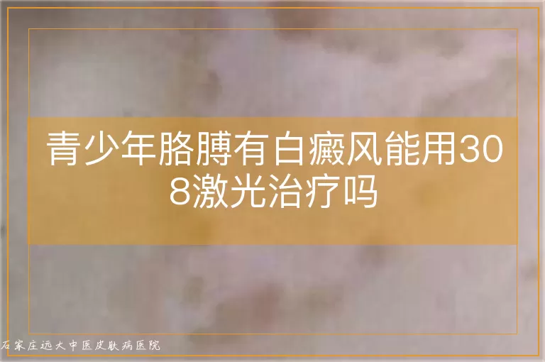 青少年胳膊有白癜风能用308激光治疗吗