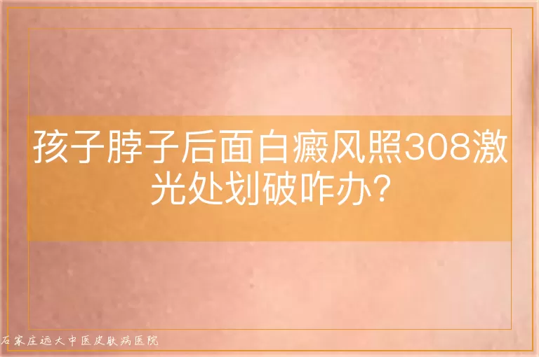 孩子脖子后面白癜风照308激光处划破咋办？