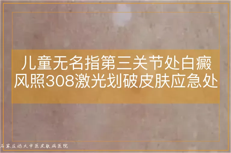 儿童无名指第三关节处白癜风照308激光划破皮肤应急处理指南