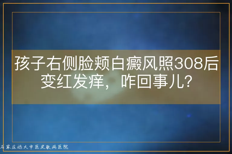 孩子右侧脸颊白癜风照308后变红发痒，咋回事儿？
