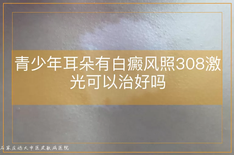 青少年耳朵有白癜风照308激光可以治好吗
