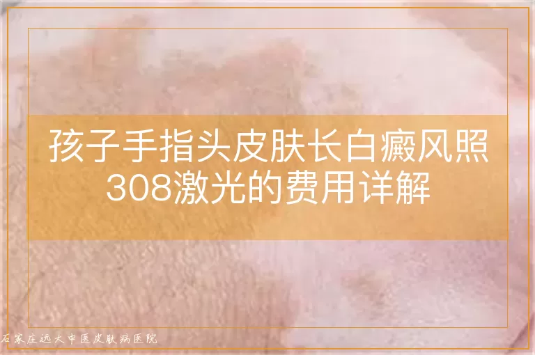 孩子手指头皮肤长白癜风照308激光的费用详解