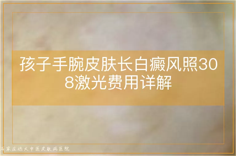 孩子手腕皮肤长白癜风照308激光费用详解