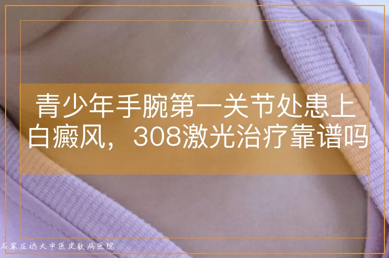 青少年手腕第一关节处患上白癜风，308激光治疗靠谱吗？