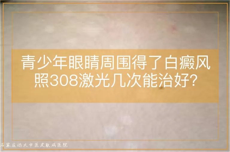 青少年眼睛周围得了白癜风照308激光几次能治好？
