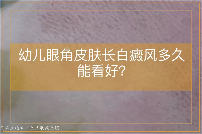 幼儿眼角皮肤长白癜风多久能看好?