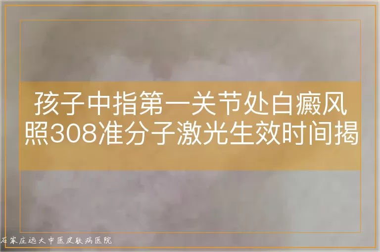 孩子中指第一关节处白癜风照308准分子激光生效时间揭秘