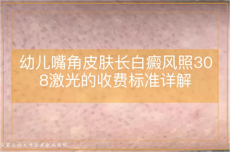 幼儿嘴角皮肤长白癜风照308激光的收费标准详解