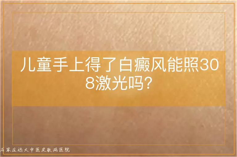 儿童手上得了白癜风能照308激光吗？