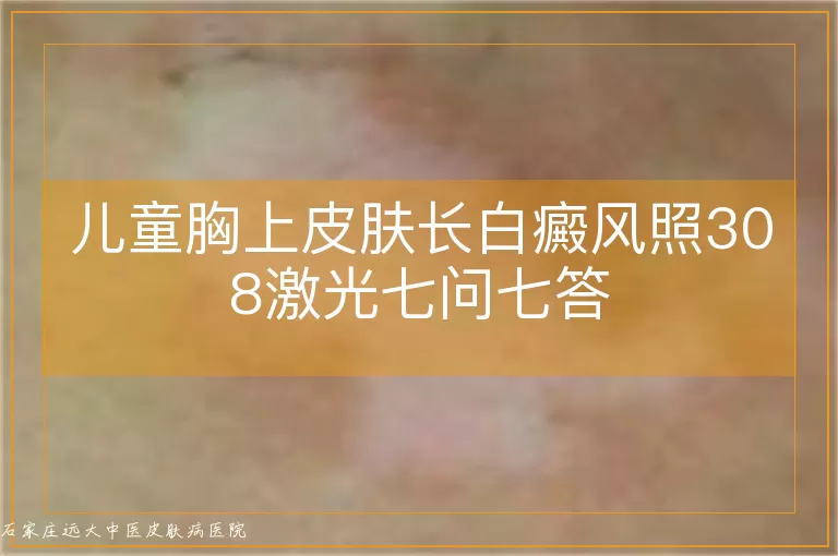儿童胸上皮肤长白癜风照308激光七问七答