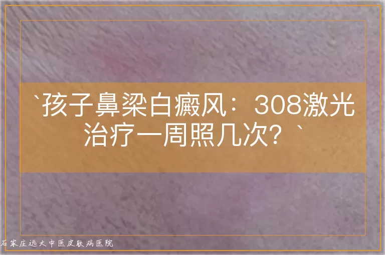 孩子鼻梁白癜风：308激光治疗一周照几次？