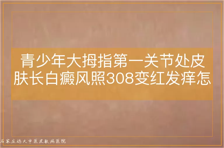 青少年大拇指第一关节处皮肤长白癜风照308变红发痒怎么办？