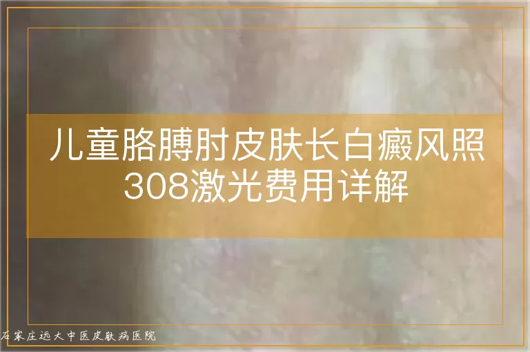 儿童胳膊肘皮肤长白癜风照308激光费用详解