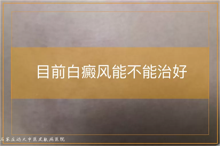 目前白癜风能不能治好