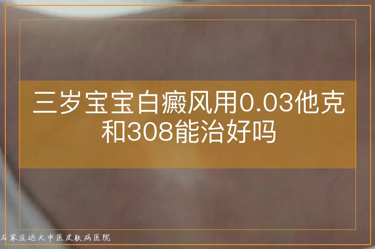 三岁宝宝白癜风用0.03他克和308能治好吗
