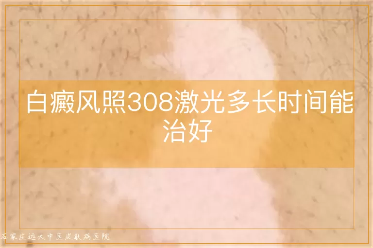 白癜风照308激光多长时间能治好