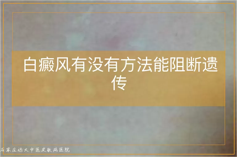 白癜风有没有方法能阻断遗传
