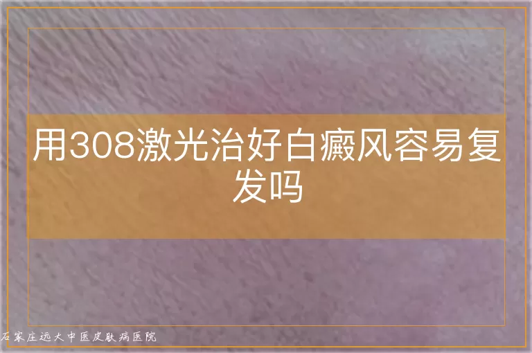 用308激光治好白癜风容易复发吗