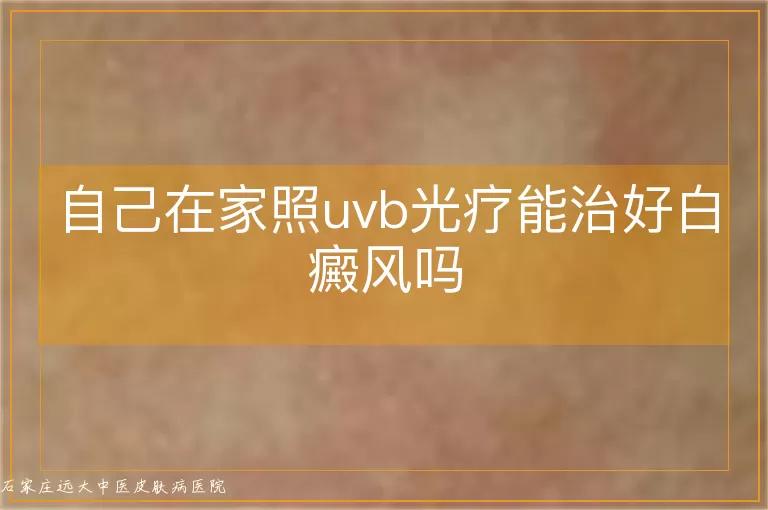 自己在家照uvb光疗能治好白癜风吗