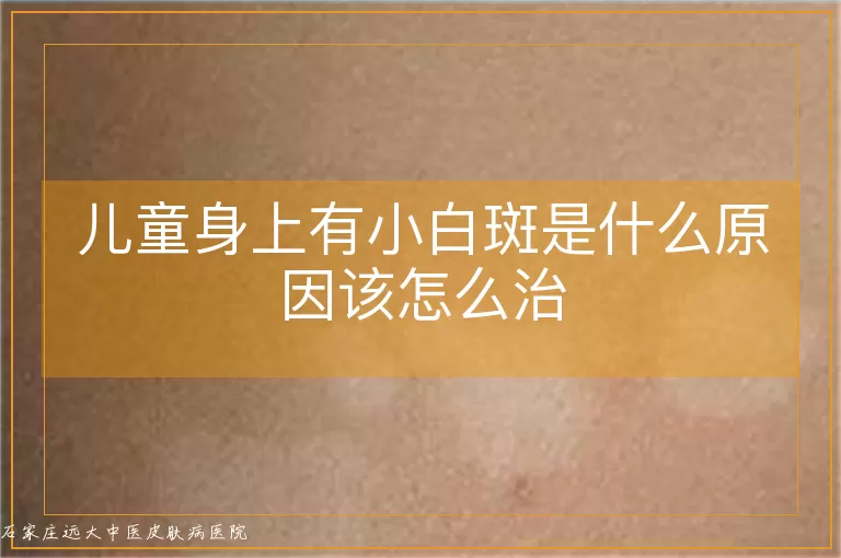 儿童身上有小白斑是什么原因该怎么治