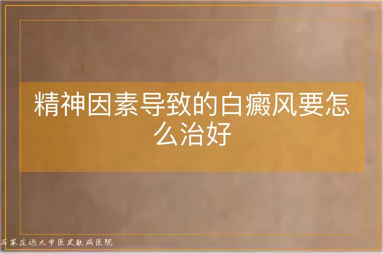 精神因素导致的白癜风要怎么治好