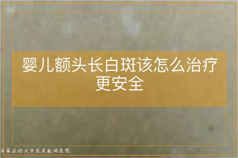 婴儿额头长白斑该怎么治疗更安全