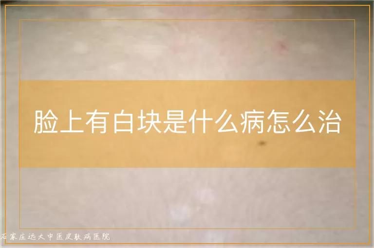 脸上有白块是什么病怎么治