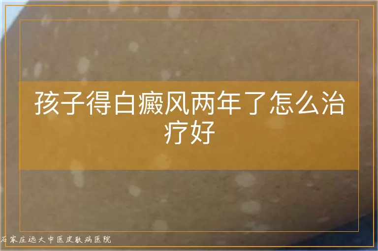 孩子得白癜风两年了怎么治疗好