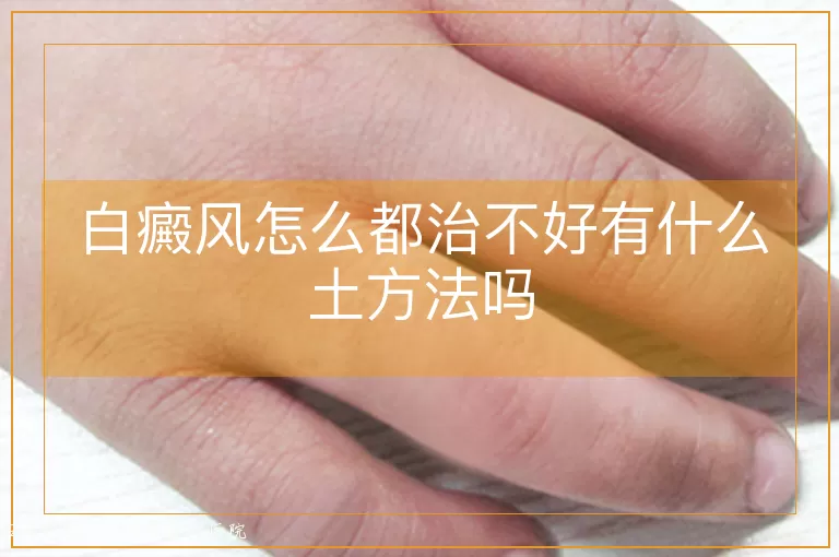 白癜风怎么都治不好有什么土方法吗