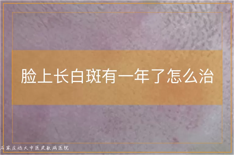脸上长白斑有一年了怎么治