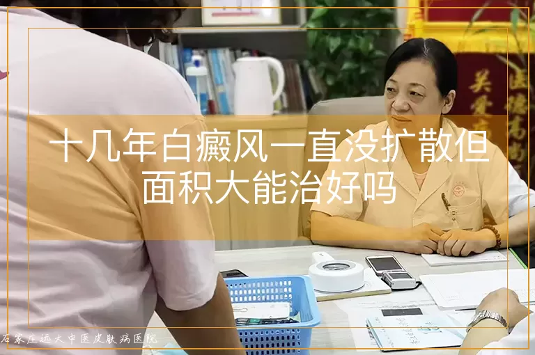 十几年白癜风一直没扩散但面积大能治好吗