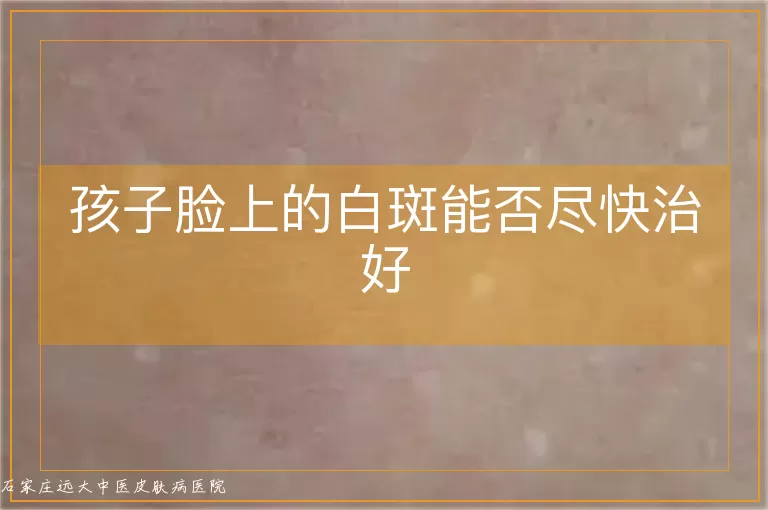 孩子脸上的白斑能否尽快治好