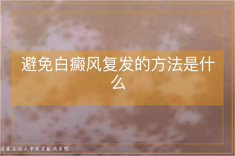 避免白癜风复发的方法是什么