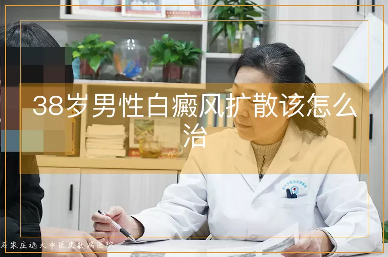 38岁男性白癜风扩散该怎么治