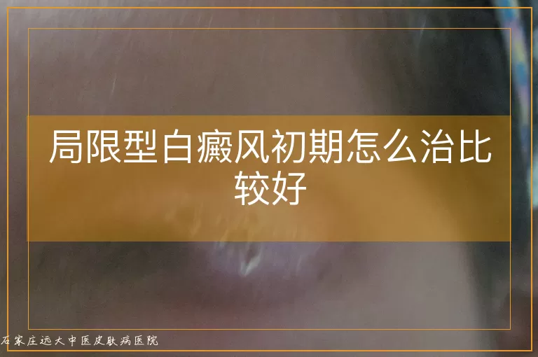 局限型白癜风初期怎么治比较好