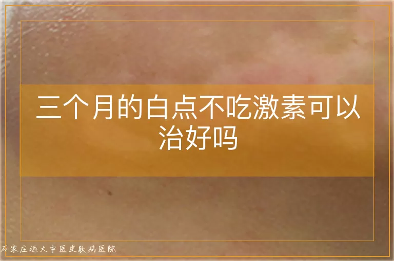 三个月的白点不吃激素可以治好吗
