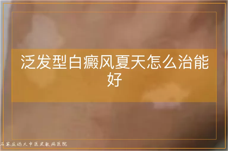 泛发型白癜风夏天怎么治能好