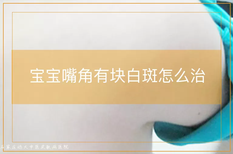 宝宝嘴角有块白斑怎么治