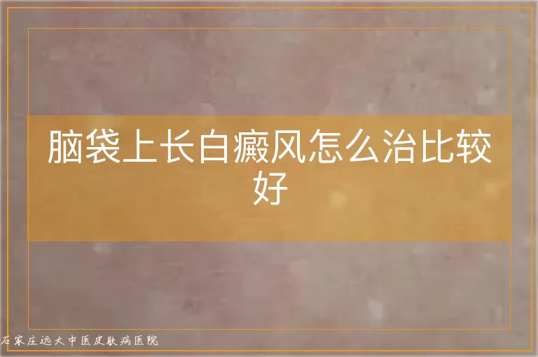 脑袋上长白癜风怎么治比较好