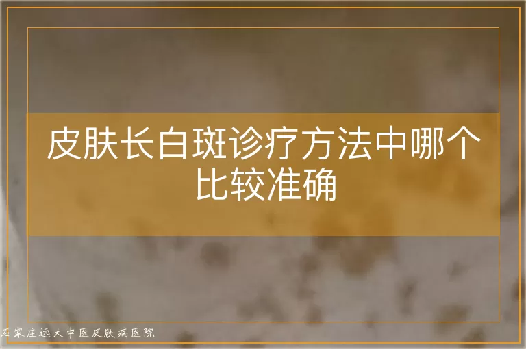 皮肤长白斑诊疗方法中哪个比较准确