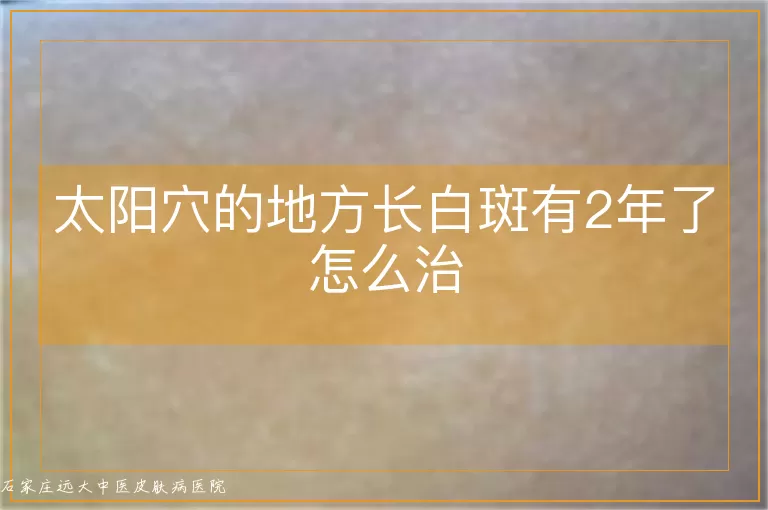 太阳穴的地方长白斑有2年了怎么治