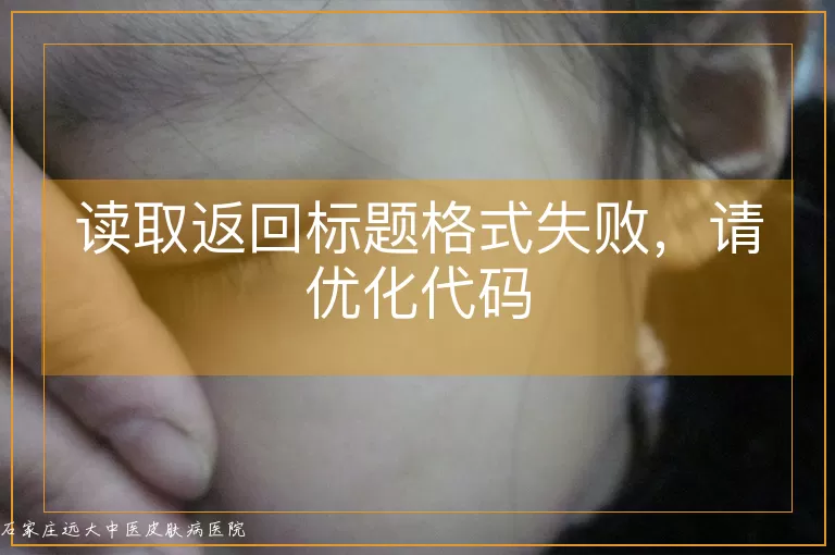 读取返回标题格式失败，请优化代码