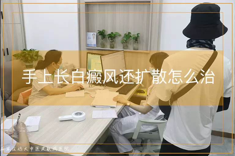 手上长白癜风还扩散怎么治