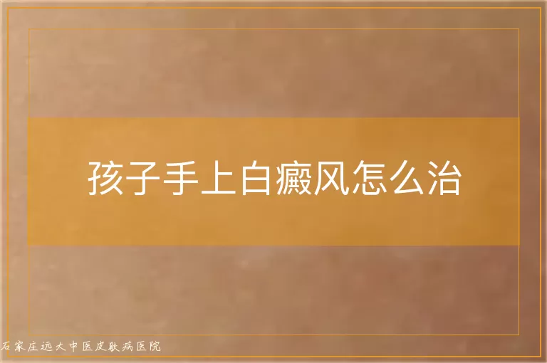 孩子手上白癜风怎么治