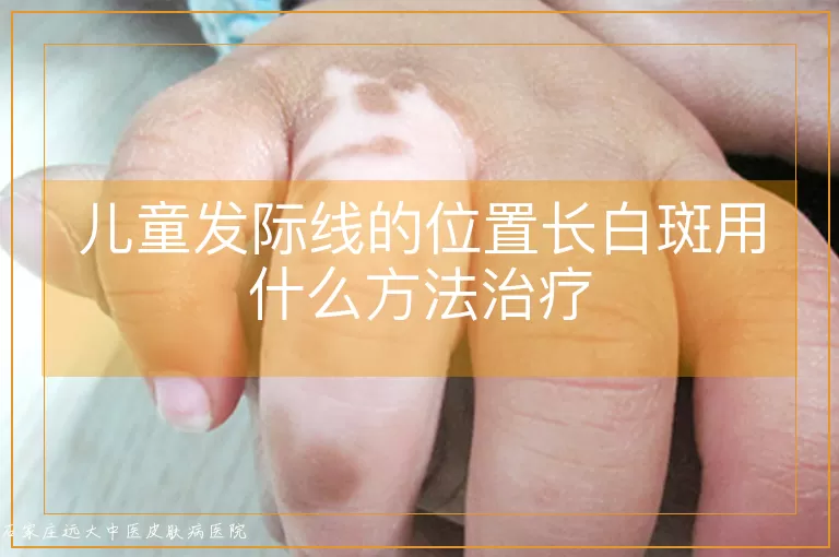 儿童发际线的位置长白斑用什么方法治疗