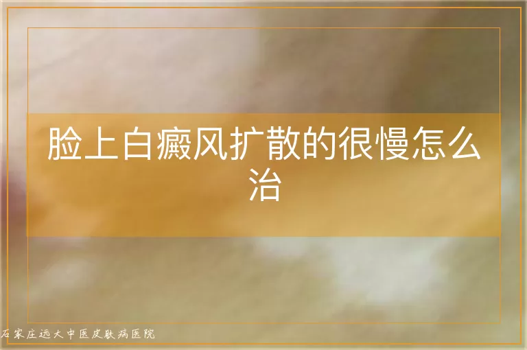 脸上白癜风扩散的很慢怎么治