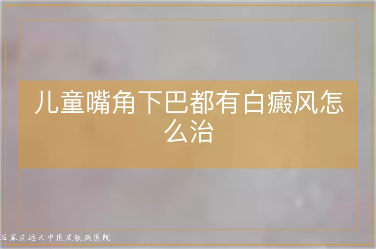 儿童嘴角下巴都有白癜风怎么治